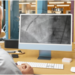 ct coronary angiogram