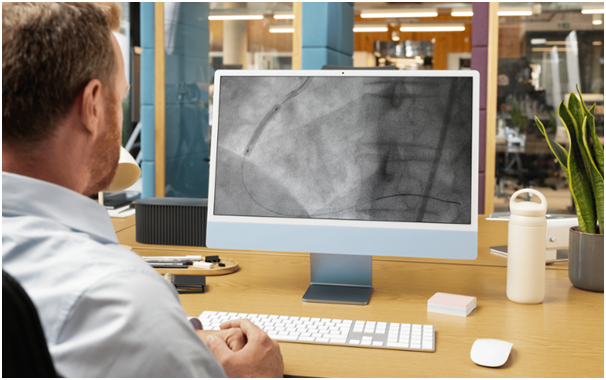 ct coronary angiogram